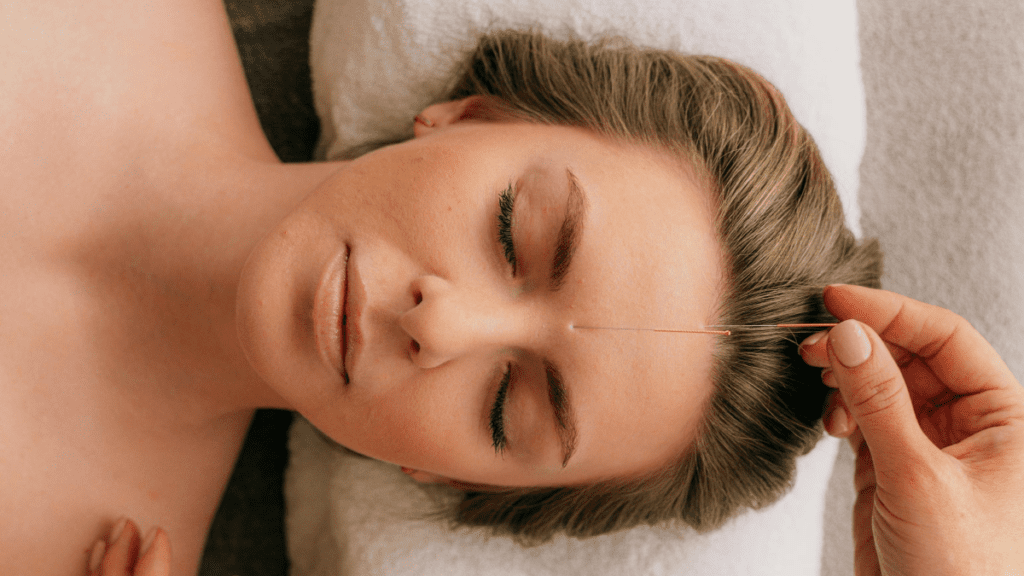 Agopuntura viso_3 | Treatwell